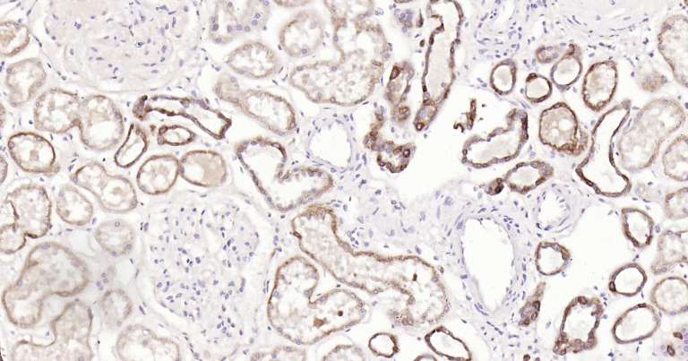 人细胞角蛋白18即用型免疫组化试剂盒-IHC0249H
